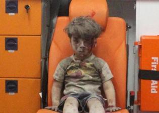 Oman Daqneesh, dazed Syrian boy's brother dies