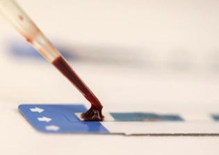 HIV/AIDS cure news: Interferon production may accelerate the spread of HIV infection, studies show