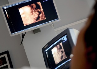 Federal judge blocks Indiana law that would require ultrasound before abortions