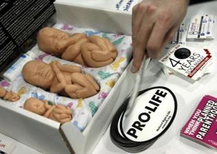 Trump picks pro-life advocate to lead national family planning programs