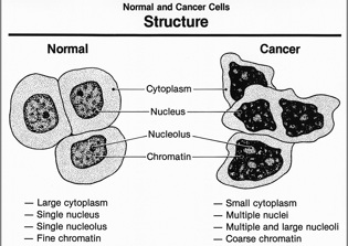 Cancer Cure? Eight-Year-Old Girl Suggests Antibiotics To Kill Cancer Cells – Tests Indicate She Could Be Right!