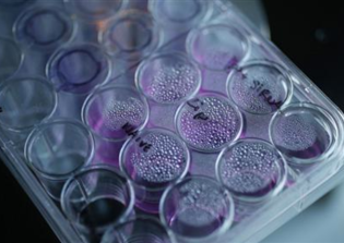 Cancer cure news update: New treatment from California's City of Hope made tumors disappear