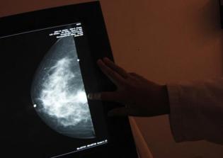 Breast Cancer cure news update 2016: Capsaicin, helional can inhibit cancer cell growth, recent study says