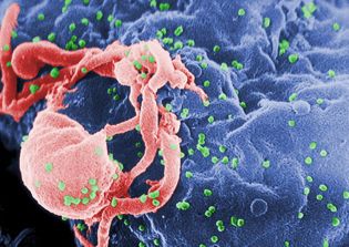 HIV and AIDS cure news 2016: Doctor who first reported about AIDS says cure is possible