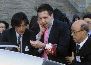 U.S. Ambassador Suffers Wounds to Wrist, Face in South Korea Knife Attack